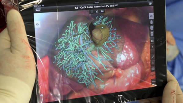 liver-surgery